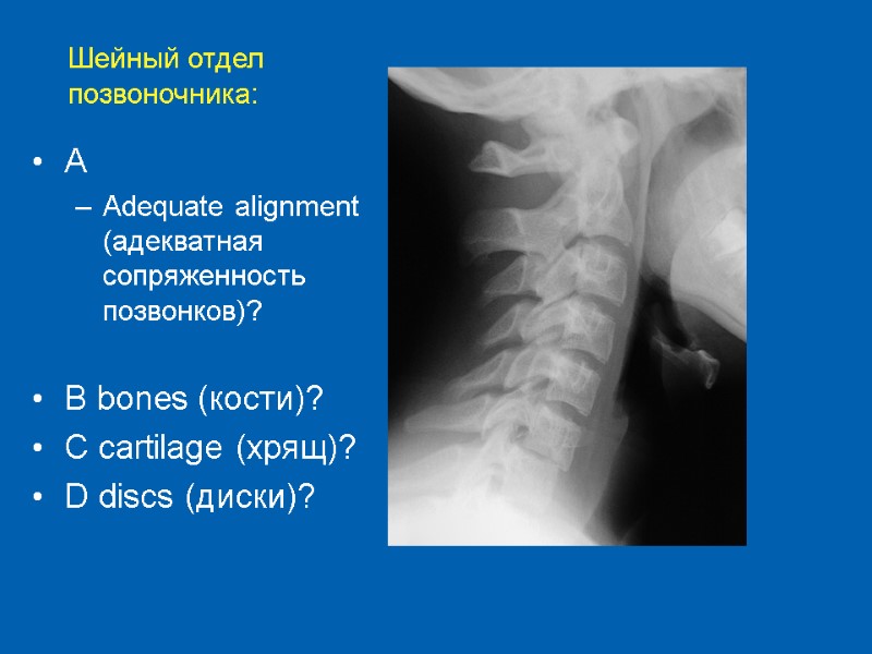 A  Adequate alignment (адекватная сопряженность позвонков)?   B bones (кости)? C cartilage